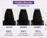 Bare Anatomy Rosemary & Rice Water Hair Growth Spray | Strengthens Roots & Promotes Thicker Hair | 100ml